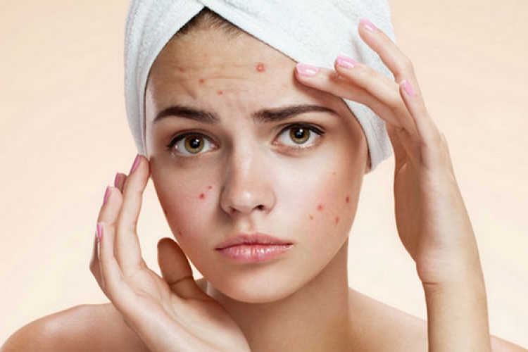 10 dolog, amivel árthatunk a bőrünknek
